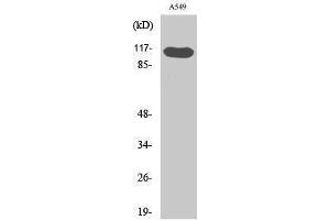 Western Blotting (WB) image for anti-HRS (HRS) (pTyr216) antibody (ABIN3172906) (HRS (HRS) (pTyr216) anticorps)