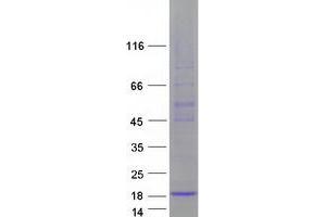 Validation with Western Blot