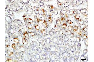 Formalin-fixed and paraffin embedded rat colon tissue labeled with Rabbit Anti-Leptin receptor(long) Polyclonal Antibody (ABIN725060) at 1:200 followed by conjugation to the secondary antibody and DAB staining.