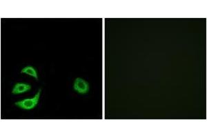 Immunofluorescence analysis of A549 cells, using ACOT8 Antibody.