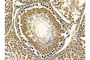 ABIN7095646 and ABIN7099708 at 1/100 staining rat testis tissue by IHC-P.
