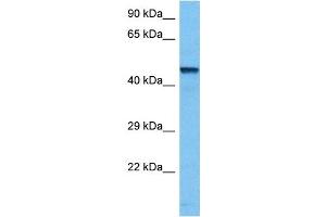 Host:  Mouse  Target Name:  TFAP2B  Sample Tissue:  Mouse Kidney  Antibody Dilution:  1ug/ml (TFAP2B anticorps  (N-Term))