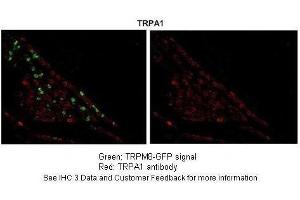 Sample Type :  Section of TRPM8-GFP transgenic mouse trigeminal ganglia  Primary Antibody Dilution :  1:250  Secondary Antibody :  Goat Anti-Rabbit Alexa-Fluor 594  Secondary Antibody Dilution :  1:1000  Color/Signal Descriptions :  TRPA1: Red TRPM8-GFP:: Green  Gene Name :  TRPA1  Submitted by :  Dr.
