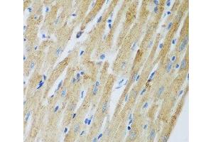 Immunohistochemistry of paraffin-embedded Rat heart using ADAM12 Polyclonal Antibody at dilution of 1:100 (40x lens).