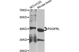 Western blot analysis of extracts of NCI-H125 and mouse brain cell lines, using PDGFRL antibody. (PDGFRL anticorps)