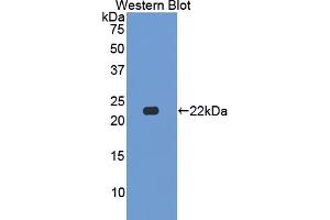 Western blot analysis of the recombinant protein. (CSN2 anticorps  (AA 41-198))