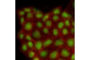 Immunofluorescenitrocellulosee of human MCF7 cells stained with Phalloidin-TRITC (Red) for Actin staining and monoclonal anti-human MAPK1 antibody (1:500) with Alexa 488 (Green). (ERK2 anticorps)