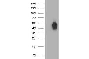 Western Blotting (WB) image for anti-Beclin 1, Autophagy Related (BECN1) antibody (ABIN1496866) (Beclin 1 anticorps)