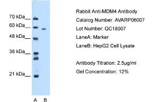 WB Suggested Anti-MDM4 AntibodyTitration: 2. (MDM4-binding Protein anticorps  (N-Term))