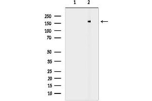 anti-Deleted in Liver Cancer 1 (DLC1) (N-Term) antibody