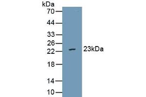 anti-Von Willebrand Factor A Domain Containing 5B2 (VWA5B2) (AA 354-527) antibody