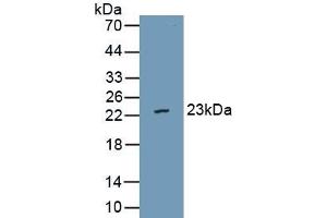 Detection of Recombinant vWA5B2, Human using Polyclonal Antibody to Von Willebrand Factor A Domain Containing Protein 5B2 (vWA5B2) (VWA5B2 anticorps  (AA 354-527))