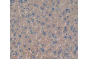 Used in DAB staining on fromalin fixed paraffin- embedded liver tissue