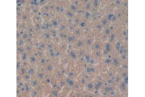 Used in DAB staining on fromalin fixed paraffin- embedded liver tissue (Tec Protein Tyrosine Kinase (TEC) (AA 369-622) anticorps)