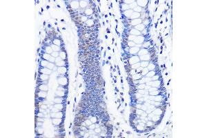 Immunohistochemistry of paraffin-embedded human colon using AhR Rabbit mAb (ABIN7265679) at dilution of 1:100 (40x lens). (Aryl Hydrocarbon Receptor anticorps)