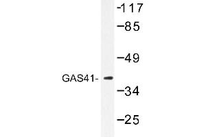 Image no. 1 for anti-YEATS Domain Containing 4 antibody (ABIN272151) (GAS41 anticorps)