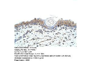 Rabbit Anti-RBMS1 Antibody  Paraffin Embedded Tissue: Human Skin Cellular Data: Squamous epithelial cells Antibody Concentration: 4.