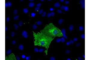 Anti-KIAA1609 mouse monoclonal antibody (ABIN2453206) immunofluorescent staining of COS7 cells transiently transfected by pCMV6-ENTRY KIAA1609 (RC209287). (KIAA1609 anticorps)