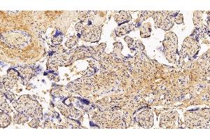 Detection of PIIINP in Human Placenta Tissue using Monoclonal Antibody to Procollagen III N-Terminal Propeptide (PIIINP)
