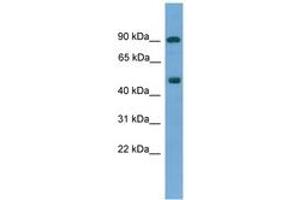 Image no. 1 for anti-Mediator Complex Subunit 25 (MED25) (AA 33-82) antibody (ABIN6745504) (MED25 anticorps  (AA 33-82))