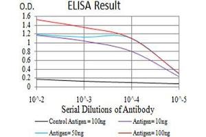 Black line: Control Antigen (100 ng);Purple line: Antigen (10ng); Blue line: Antigen (50 ng); Red line:Antigen (100 ng)