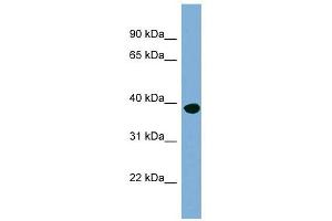 OAS1 antibody used at 1 ug/ml to detect target protein. (OAS1 anticorps  (N-Term))
