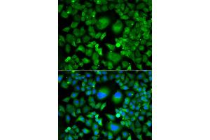 Immunofluorescence analysis of A549 cells using UBE2H antibody. (UBE2H anticorps)