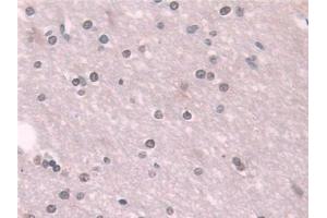 Detection of TKT in Human Cerebrum Tissue using Polyclonal Antibody to Transketolase (TKT)