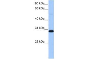 Western Blotting (WB) image for anti-Tryptophanyl tRNA Synthetase 2, Mitochondrial (WARS2) antibody (ABIN2463510)