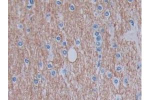 Detection of GHRH in Human Cerebrum Tissue using Monoclonal Antibody to Growth Hormone Releasing Hormone (GHRH)