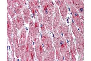 Immunohistochemistry (IHC) image for anti-Dystrophia Myotonica-Protein Kinase (DMPK) (Middle Region) antibody (ABIN2775281)