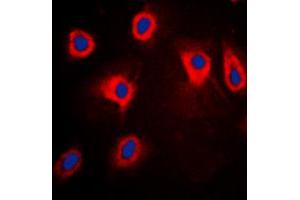 Immunofluorescent analysis of TPL2 (pT290) staining in HepG2 cells. (MAP3K8 anticorps  (pSer290))