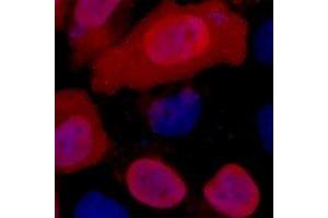 Immunofluorescent analysis of Myc-tag staining in 293T cells transfected with a Myc-tag protein.
