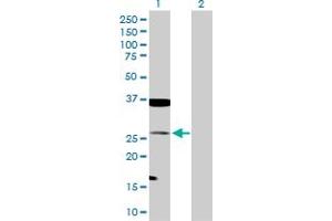 Western Blot analysis of TAGLN expression in transfected 293T cell line by TAGLN MaxPab polyclonal antibody. (Transgelin anticorps  (AA 1-201))
