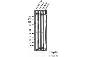 Western blot analysis of Phospho-DARPP-32 (Thr75) expression in various lysates
