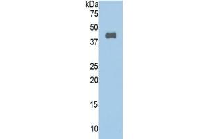 WB of Protein Standard: different control antibodies against Highly purified E.