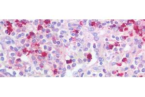 Detection of NE in Human Spleen Tissue using Polyclonal Antibody to Neutrophil Elastase (NE)