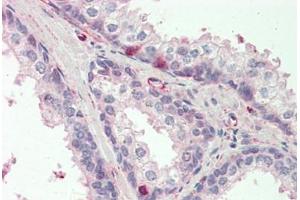 Human Prostate: Formalin-Fixed, Paraffin-Embedded (FFPE)