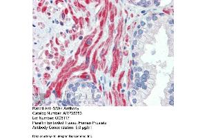 Immunohistochemistry with Human Prostate lysate tissue at an antibody concentration of 5. (SSX4 anticorps  (Middle Region))