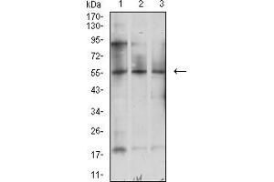 Western blot analysis using ATG5 mouse mAb against K562 (1), SH-SY5Y (2), and HCT116 (3) cell lysate. (ATG5 anticorps  (AA 144-275))
