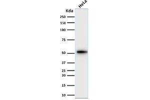 Western Blot Analysis of human HeLa cell lysate using Cytokeratin-7 Mouse Monoclonal Antibody (KRT7/2200). (Cytokeratin 7 anticorps)