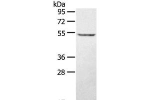 Western Blot analysis of A431 cell using STYK1 Polyclonal Antibody at dilution of 1:500 (STYK1 anticorps)