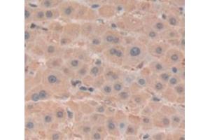IHC-P analysis of Human Tissue, with DAB staining. (BHMT anticorps  (AA 11-314))