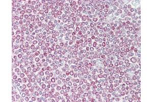 Anti-CXCL14 antibody IHC of human spleen.