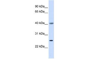 WB Suggested Anti-ADA Antibody Titration: 0. (ADA anticorps  (Middle Region))