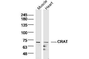Lane 1: Mouse muscle lysates, Lane 2: mouse heart lysates probed with CRAT/CAT1 Polyclonal Antibody, Unconjugated  at 1:300 overnight at 4˚C.