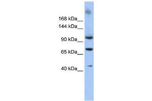 Western Blotting (WB) image for anti-Terminal Uridylyl Transferase 1, U6 SnRNA-Specific (TUT1) antibody (ABIN2458014) (TUT1 anticorps)