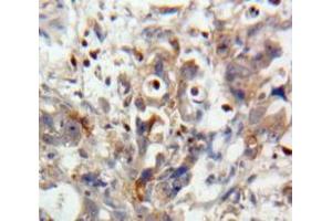 Used in DAB staining on fromalin fixed paraffin-embedded Pancreas tissue (IL28A anticorps  (AA 26-200))
