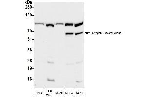 Western Blotting (WB) image for anti-Estrogen Receptor 1 (ESR1) (C-Term) antibody (ABIN7450221)