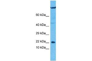 Host:  Rabbit  Target Name:  UXT  Sample Type:  U937 Whole Cell lysates  Antibody Dilution:  1. (UXT anticorps  (C-Term))